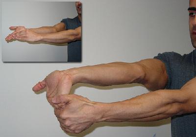 flexor-jpg.25075