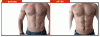 abdominal_implant.gif