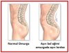 posterior pelvic tilt.jpg