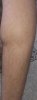 SAĞ CALF.jpg