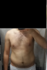 BEFORE.png