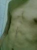 bodyforumtr.jpg