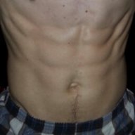 RippedVascular