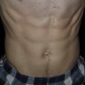 RippedVascular